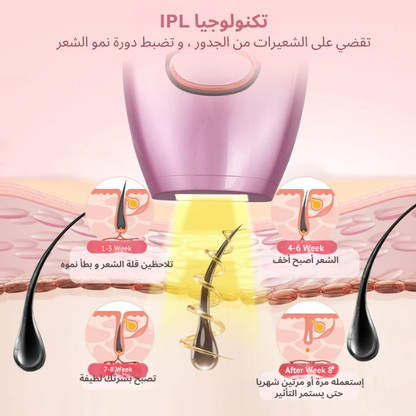 جهاز ليزر لإزالة الشعر - بدون ألم، نتائج سريعة، ونعومة طويلة